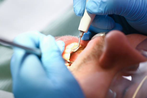 Best Dentist for Tooth Abscess  in Citrus Hills, FL