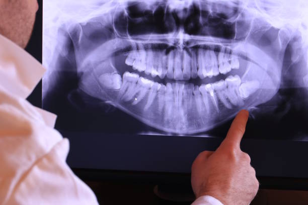 Emergency Gum Pain Relief in FL
